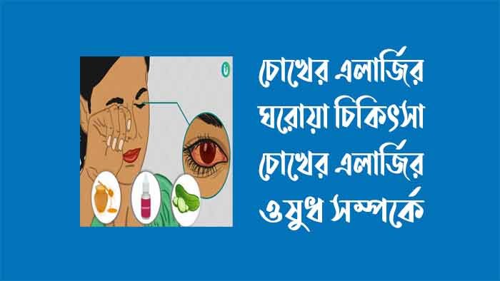 চোখের এলার্জির ঘরোয়া চিকিৎসা