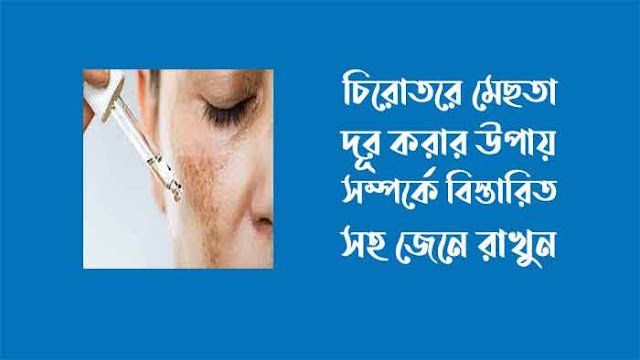 চিরতরে মেছতা দূর করার উপায়