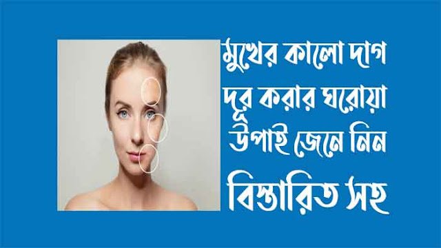 মুখের দাগ দূর করার সহজ নিয়ম