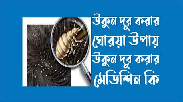 উকুন দূর করার ঘোরয়া উপায়