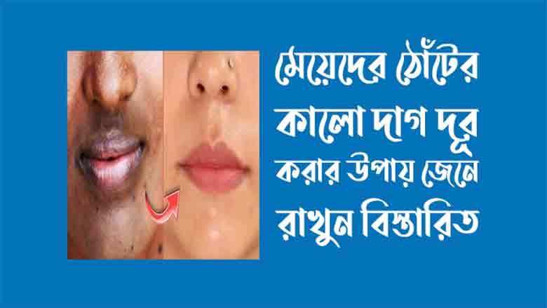 মেয়েদের ঠোঁটের কালো দাগ দূর করার উপায়