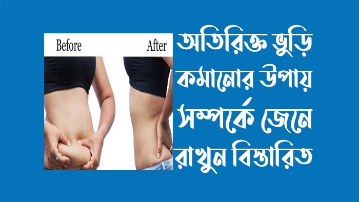 অতিরিক্ত ভুড়ি কমানোর উপায় অতিরিক্ত ভুড়ি কমানোর উপায়