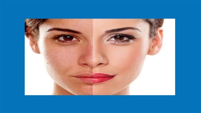 একদিনের মধ্যে মুখের কালো দাগ দূর করার দুর্দান্ত উপায়